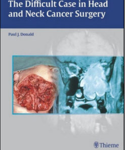 The Difficult Case in Head and Neck Cancer Surgery