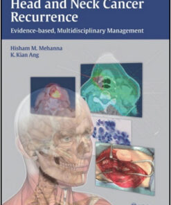 Head and Neck Cancer Recurrence: Evidence-based, Multidisciplinary Management