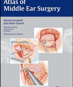 Atlas of Middle Ear Surgery