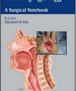 Otolaryngology: A Surgical Notebook