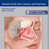 Rhinology: Diseases of the Nose, Sinuses, and Skull Base