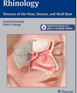 Rhinology: Diseases of the Nose, Sinuses, and Skull Base