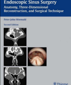 Endoscopic Sinus Surgery: Anatomy, Three-Dimensional Reconstruction, and Surgical Technique, 2nd Edition