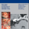 The Facial Nerve in Temporal Bone and Lateral Skull Base Microsurgery