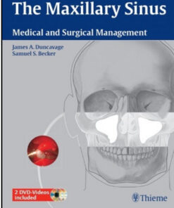 The Maxillary Sinus: Medical and Surgical Management