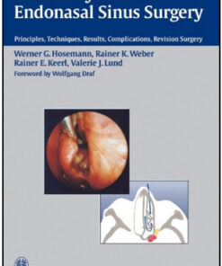 Minimally Invasive Endonasal Sinus Surgery: Principles, Techniques, Results, Complications, Revision Surgery