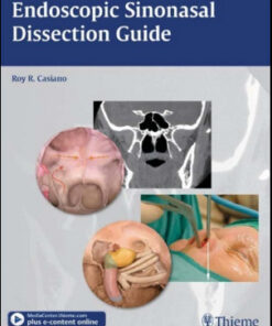 Endoscopic Sinonasal Dissection Guide