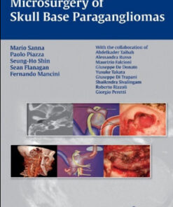 Microsurgery of Skull Base Paragangliomas