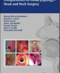 Complications in Otolaryngology-Head and Neck Surgery