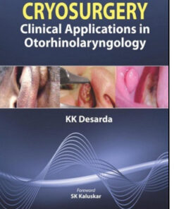 Cryosurgery: Clinical Applications in Otorhinolaryngology