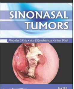 Sinonasal Tumors