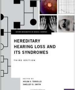 Hereditary Hearing Loss and Its Syndromes