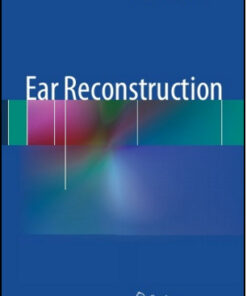 Ear Reconstruction