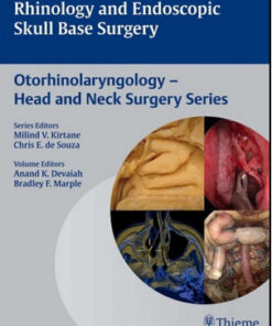 Rhinology and Endoscopic Skull Base Surgery: Otorhinolaryngology – Head and Neck Surgery Series