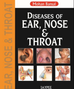 Diseases of Ear, Nose and Throat