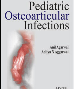 Pediatric Osteoarticular Infections