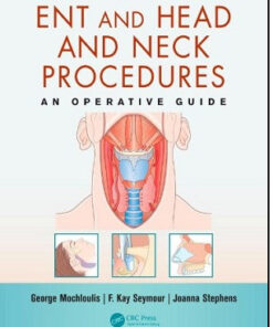 ENT and Head and Neck Procedures: An Operative Guide