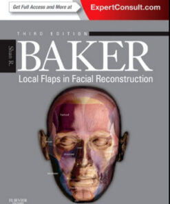 Local Flaps in Facial Reconstruction, 3rd Edition Expert Consult – Online and Print