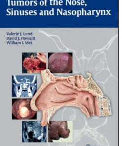 Tumors of the Nose, Sinuses and Nasopharynx