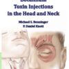 Techniques of Botulinum Toxin