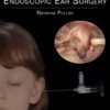 Endoscopic Ear Surgery