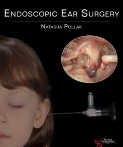 Endoscopic Ear Surgery