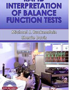 Rapid Interpretation of Balance Function Tests