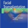 Face Transplantation: Principles, Techniques and Artistry