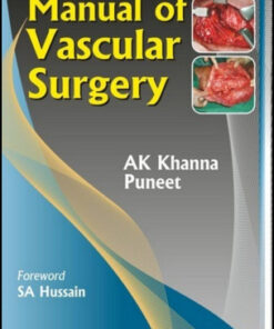 Manual of Vascular Surgery