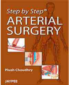 Step by Step Arterial Surgery