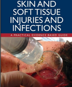 Skin and Soft Tissue Injuries and Infections: A Practical Evidence Based Guide