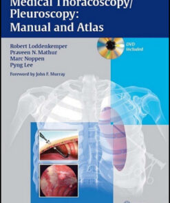 Medical Thoracoscopy/Pleuroscopy: Manual and Atlas