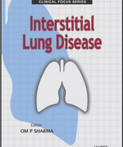 Clinical Focus Series: Interstitial Lung Disease