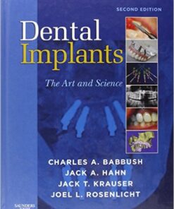 Dental Implants: The Art and Science, 2e 2nd Edition