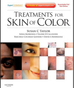 Treatments for Skin of Color