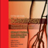 Sclerotherapy Expert Consult – Online and Print, 5th Edition Treatment of Varicose and Telangiectatic Leg Veins