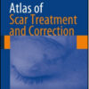 Atlas of Scar Treatment and Correction