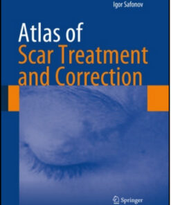 Atlas of Scar Treatment and Correction