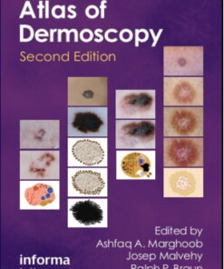 An Atlas of Dermoscopy, 2nd Edition