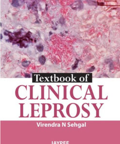 Textbook of Clinical Leprosy