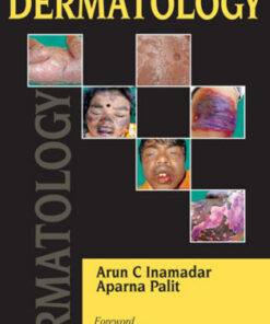 Critical Care in Dermatology