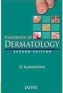 Handbook of Dermatology