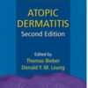 Atopic Dermatitis