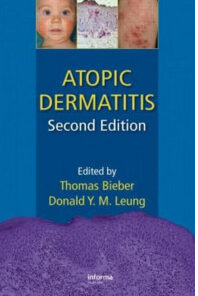 Atopic Dermatitis