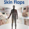 Making Decisions and Avoiding Complications in Skin Flaps