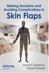 Making Decisions and Avoiding Complications in Skin Flaps