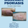 Mild to Moderate Psoriasis, Third Edition