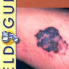 Field Guide to Clinical Dermatology / Edition 2