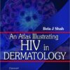 An Atlas Illustrating HIV in Dermatology