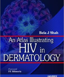 An Atlas Illustrating HIV in Dermatology